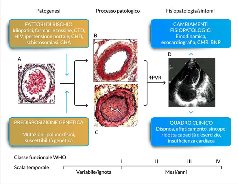 sezione-pah-meccanismi-fisiopatologici-imm2 genesi della pah