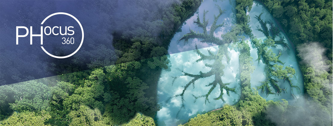 banner phocus