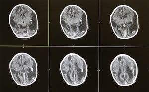 Q. How do I keep ransomware out of my backup files? Q. How do I keep ransomware out of my backup files?