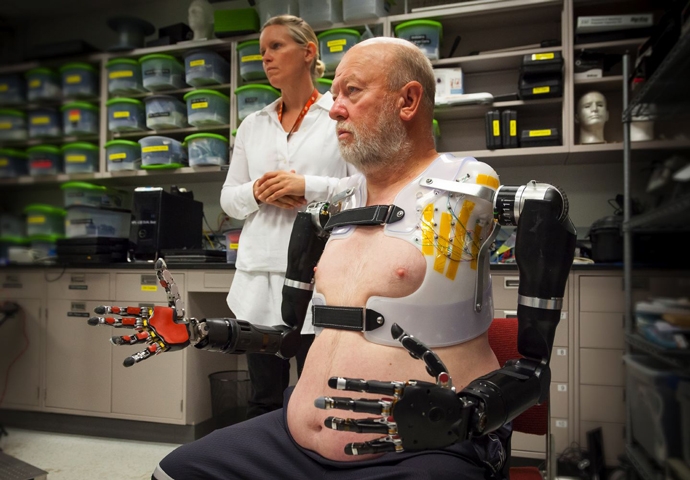 The Plastic Side Of Mind-controlled Prosthetics