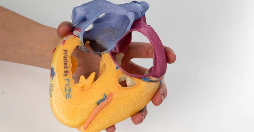 3D-printed heart model