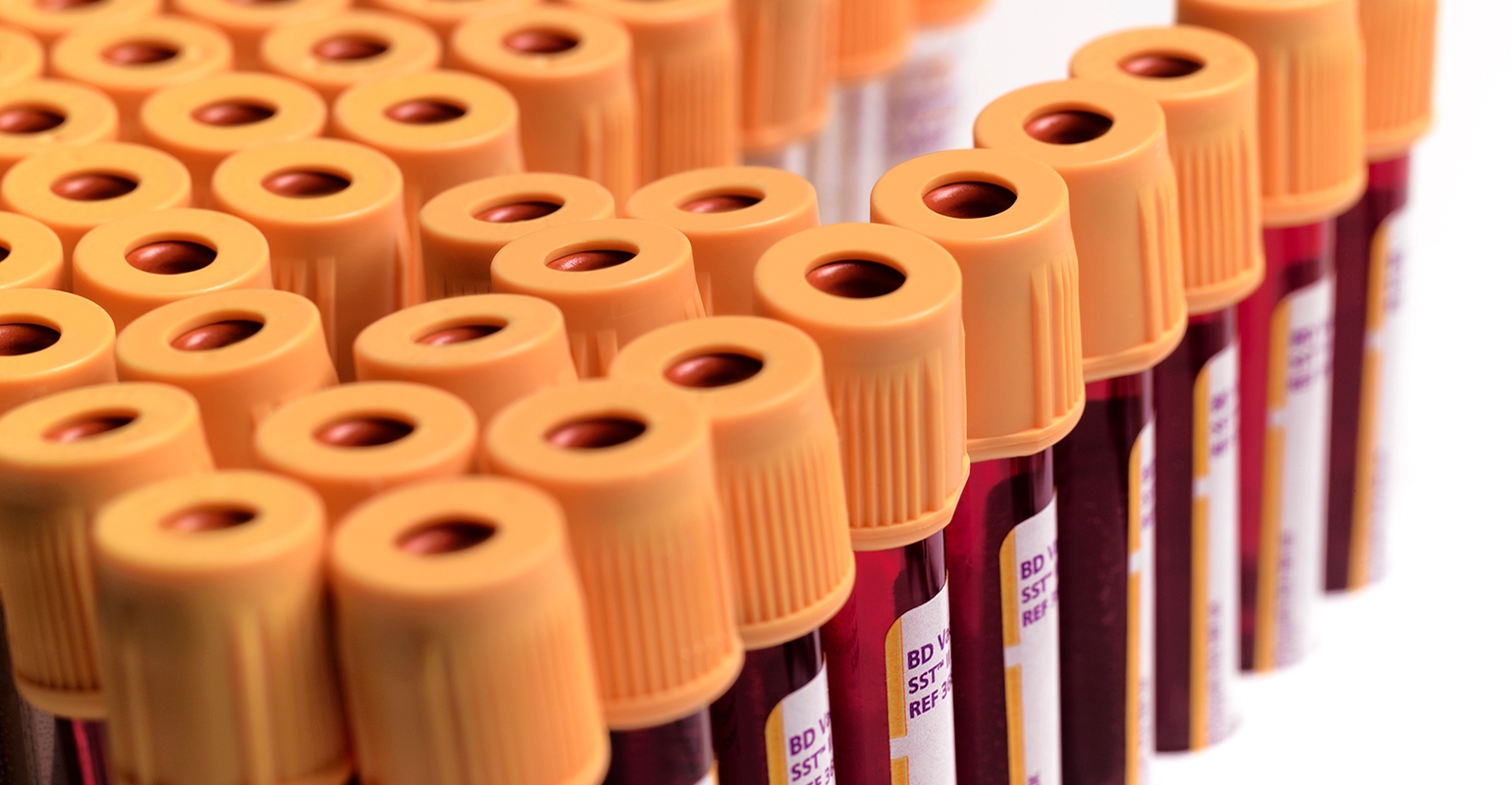 BD, Danish Stakeholders Pilot Blood Tube Recycling Program, image size:1540x800