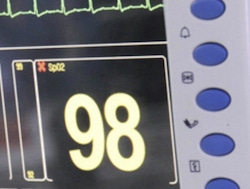 How medical device OEMs can benefit from glass-filled resins How medical device OEMs can benefit from glass-filled resins