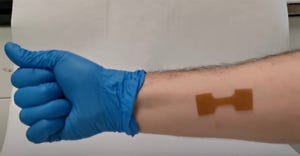 3D-printed polymer-based wound dressing