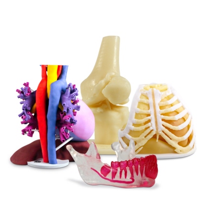 3D Systems launches on-demand medical anatomical modeling service