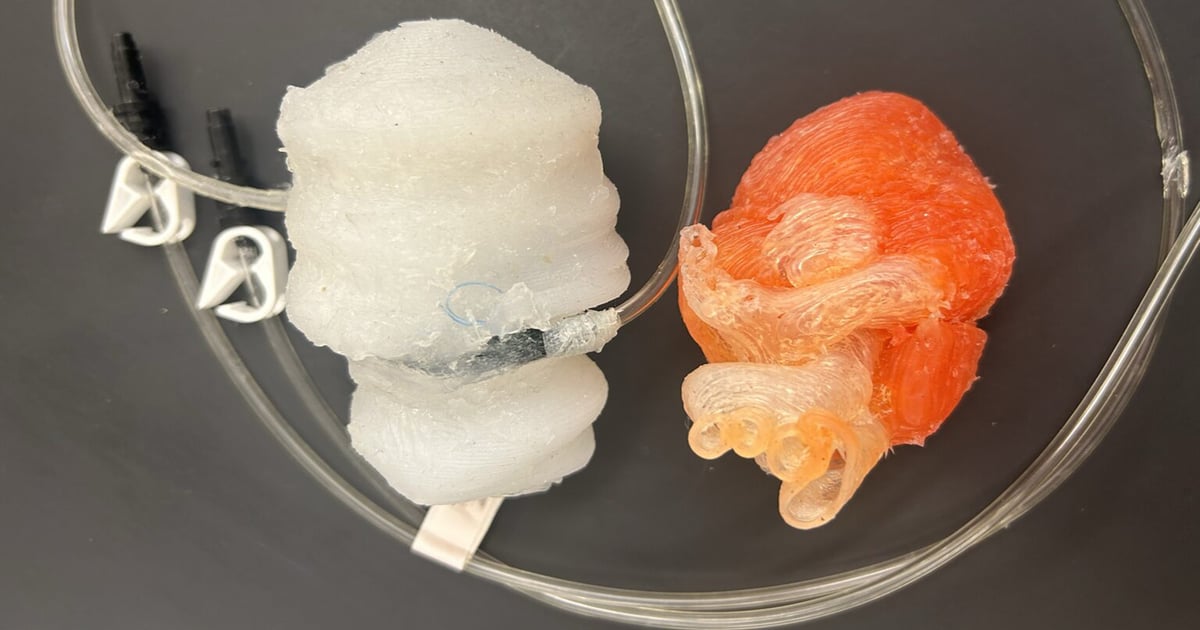 This 3D-printed Heart Beats Like the Real Thing