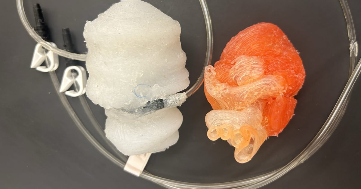This 3D-printed Heart Beats Like the Real Thing