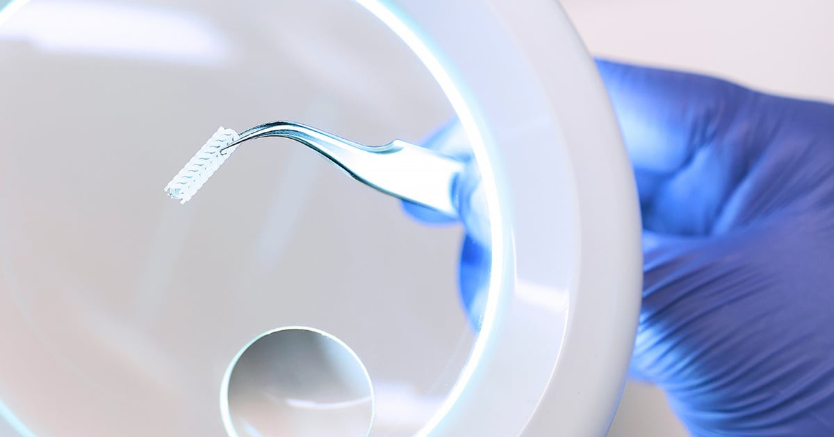 New Stent May Reduce Risk of Thrombosis