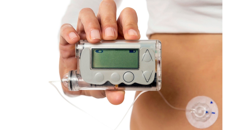 wearable insulin pump