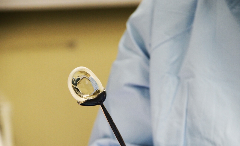 First U.S. patient receives plastic meniscus implant
