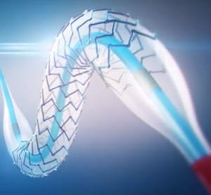 FDA approves first bioabsorable polymer drug-eluting stent