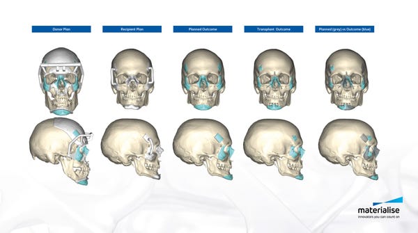 Skull-surgical_flow.jpg