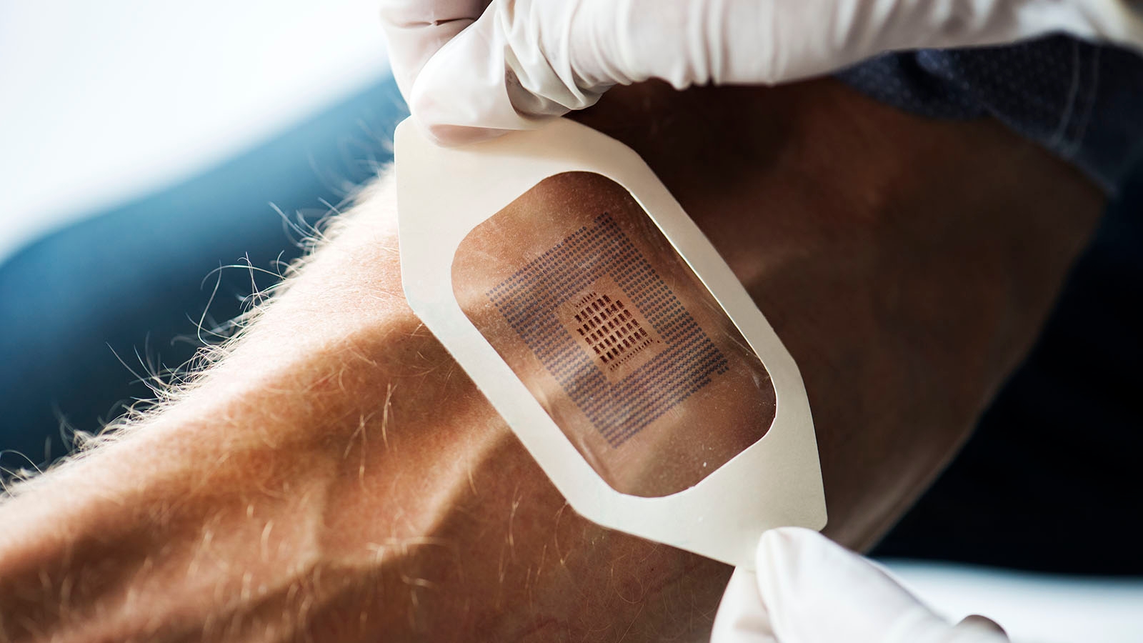 Medical Wearables a Sweet Spot for New LSR Material