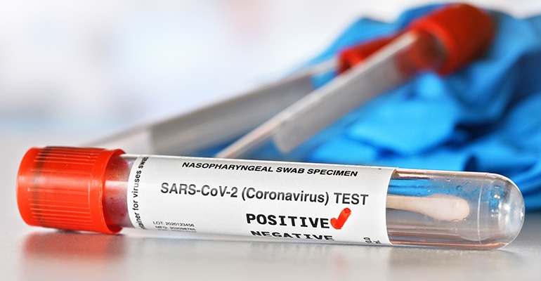 covid-19 positive test