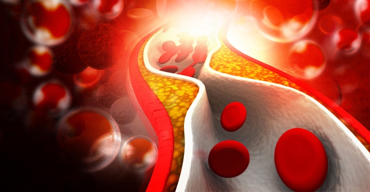 Vitamin K2-7 supplementation linked with heart health