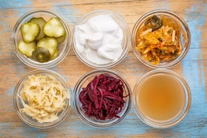 Secret shopper: Do all fermented foods have probiotics?