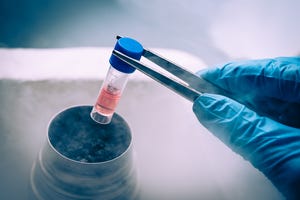 Why freezing should be a hot topic for cell therapy sector