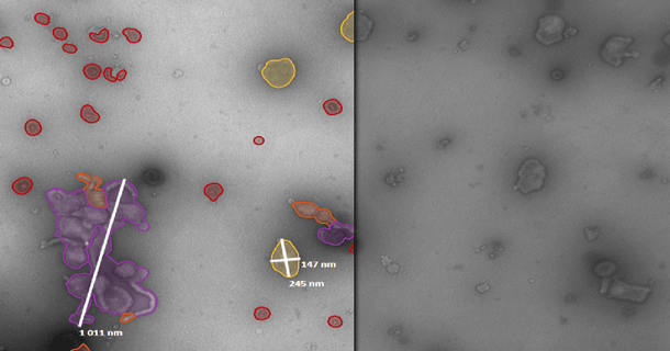 Characterization of Subvisible Particles in Vaccine Development