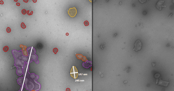 Characterization of Subvisible Particles in Vaccine Development