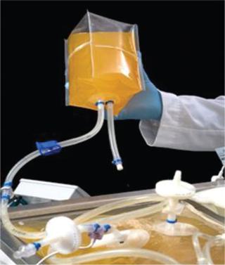 Single-Use Technologies in Cell Therapy