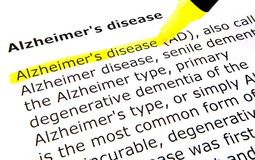 Biovian to make AAVs for ANLBIO Alzheimer’s gene therapy candidate