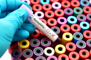 BioMarin prepares to launch Roctavian for hemophilia in an uncertain environment