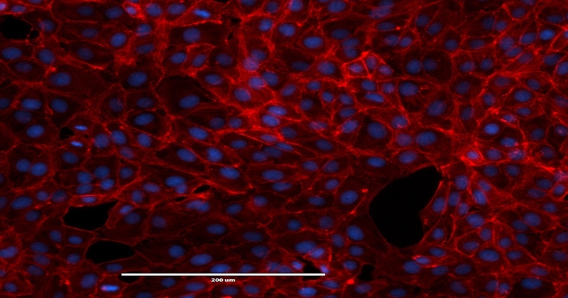 Vero Cell-based Vaccine Production: Cell lines, Media and Bioreactor ...