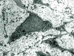 Deriving Mesenchymal Stromal Cells from Umbilical Cord Lining ...
