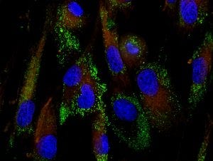 mesenchyal-stem-cells-vshivkova-300x226.jpg