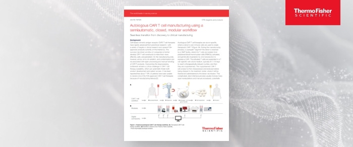 Autologous CAR T-Cell Manufacturing Using a Semi-Automatic, Closed, Modular Workflow