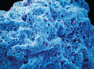 blue and purple mass of cells