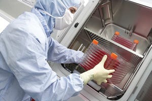 Transfection Best Practices for AAV Gene Therapy Programs