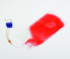 Cell Therapy Workflows Using Corning HYPERStack: MSC Production ...