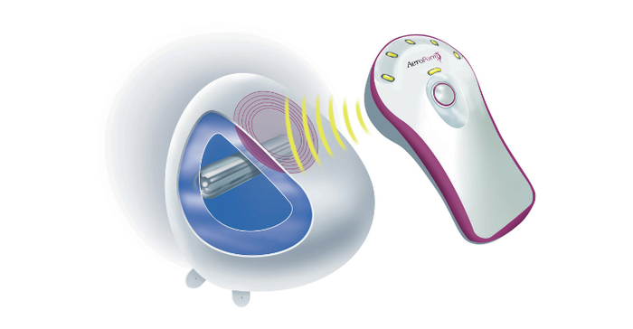 AirXpanders designed the AeroForm tissue expansion device for breast reconstruction patients.