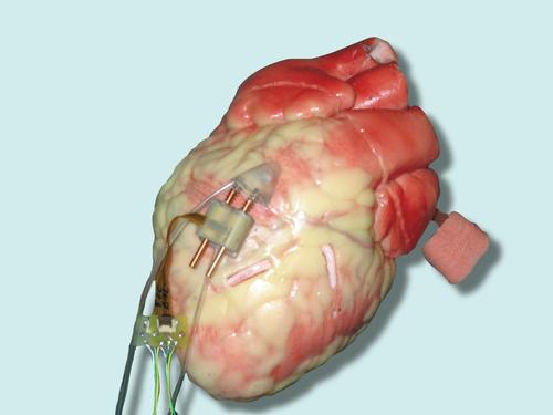 HeartLander Surgical Robot Inches Closer to Reality