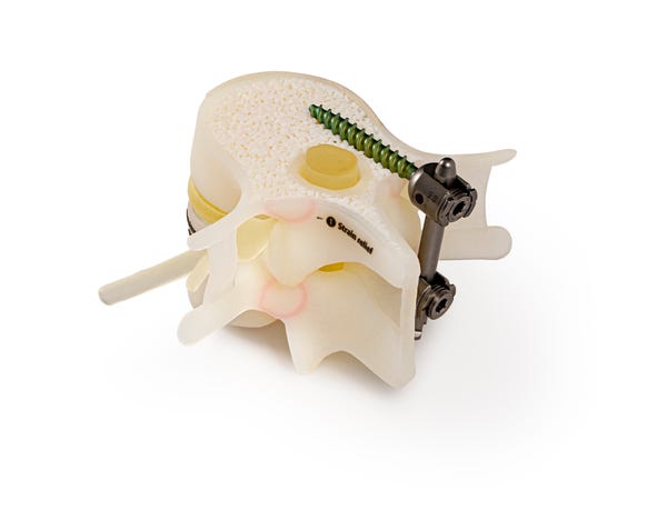 Image 4 - Spinal Pedicel Screw Insertion - Sales Kit-00784.jpg
