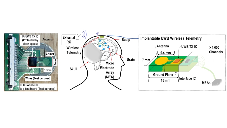 IMPLANTED MIND　エイハブ ai brain chip paralysed.png?