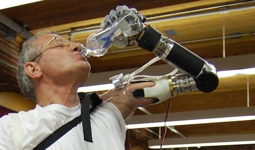 Video: Bionic Arm Aids Amputee Soldiers