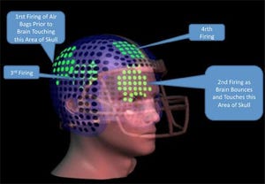 Video: Football Helmet Airbags Target Concussion Issues