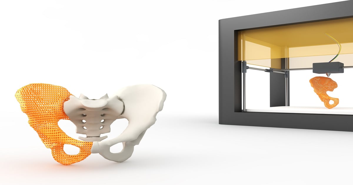 Advances in Materials and Processing Improve 3DP Results