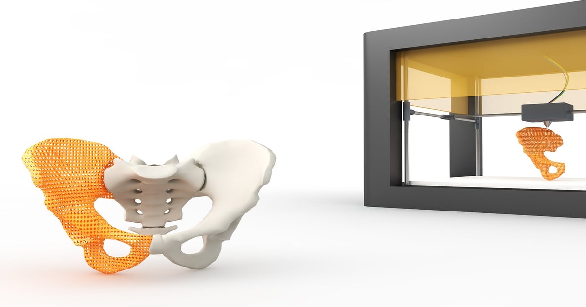 3dp Components Advances in Materials and Processing Improve 3DP Results