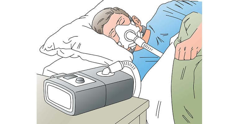 Pap Machine Cod How to Build a Better PAP Machine
