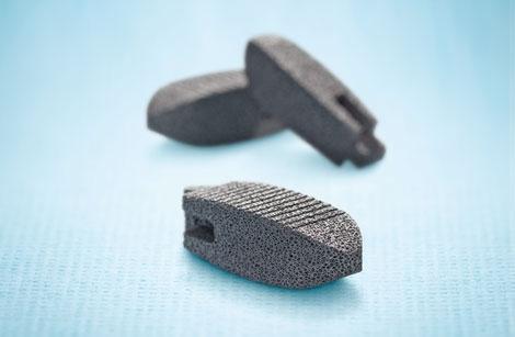 Porous Metal Spine Implant Heals Bone