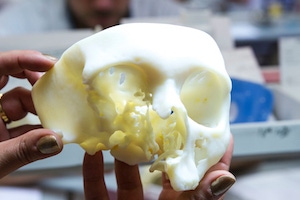 Materialise receives FDA clearance for medical 3D printing software