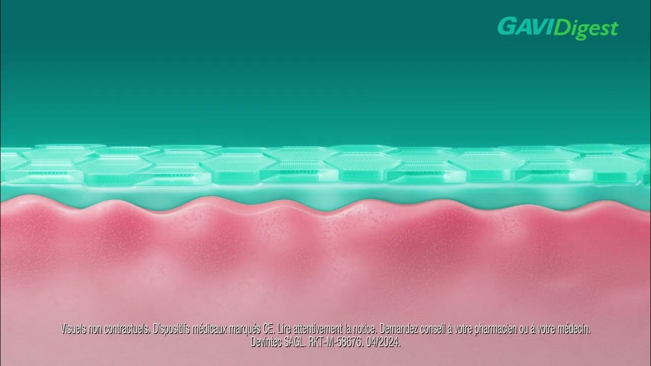 GAVIDigest soulage et prévient vos symptômes intestinaux récurrents
