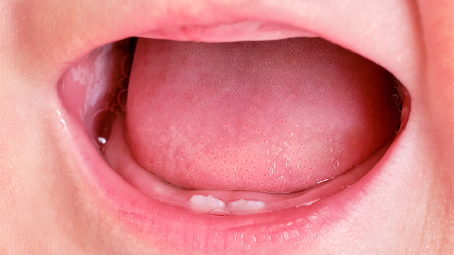 Niño con dolor dental