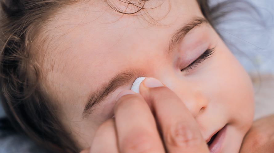 Bebé con conjuntivitis