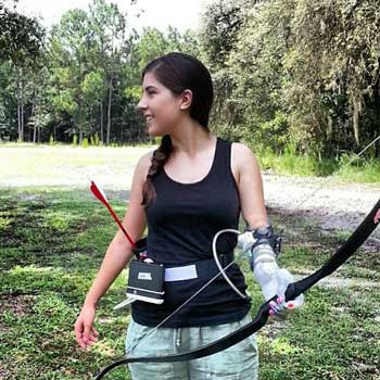 Amputee Woman with Prosthetic Hook Arm