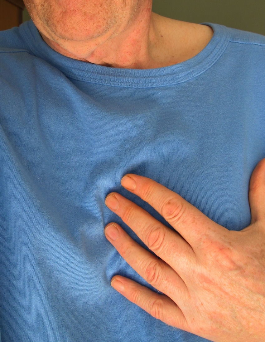 Using Imaging for Early Intervention After a Heart Attack