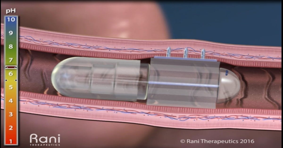 A Pill, That’s a Device, That Delivers a Drug!